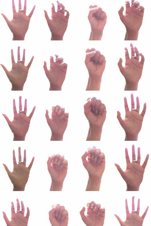 Jenny's hand, making a fist, Jon Martin